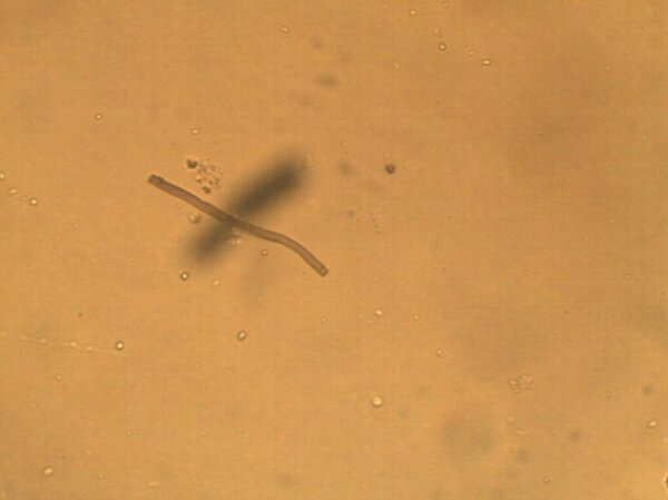 A tan fungus strand is seen under the microscope. The strand is long and thin.