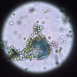 image of Aspergillus flavus under a microscope